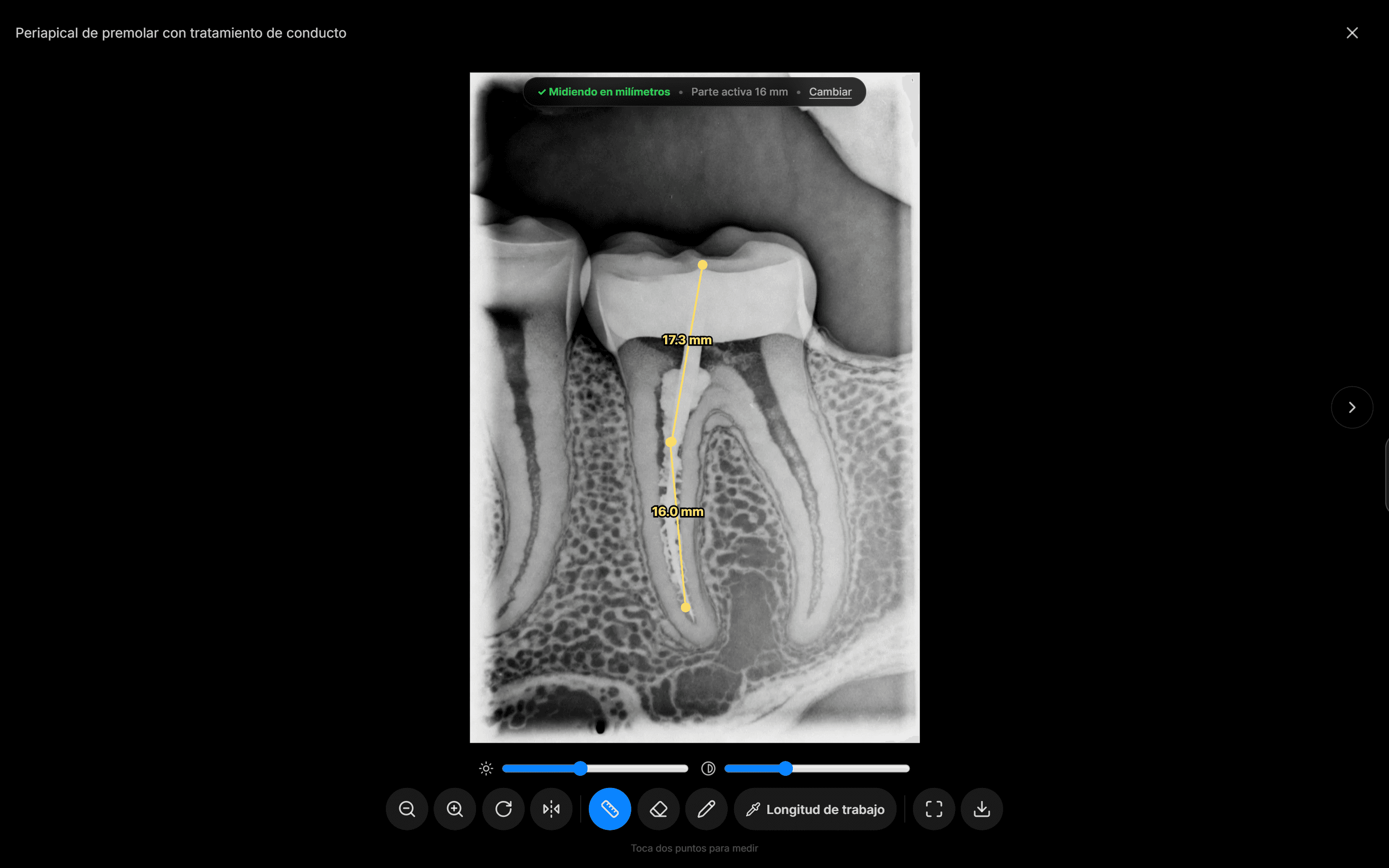 Módulo de Endodoncia en NacarOS