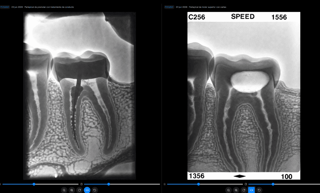 Visor de Radiografías & Comparador Antes/Después